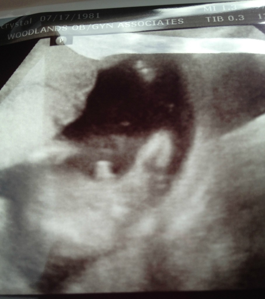 boy ultrasound picture